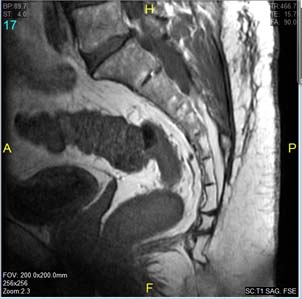 Dave T MRI