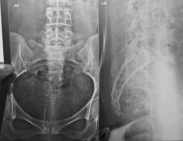 x-ray 1