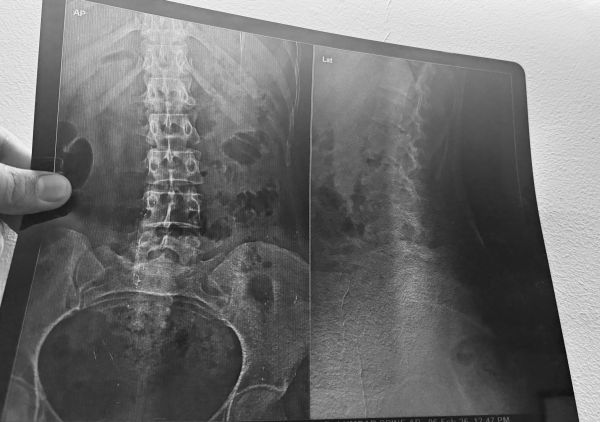 x-ray 2