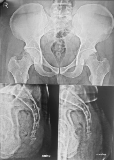 kiran x-ray