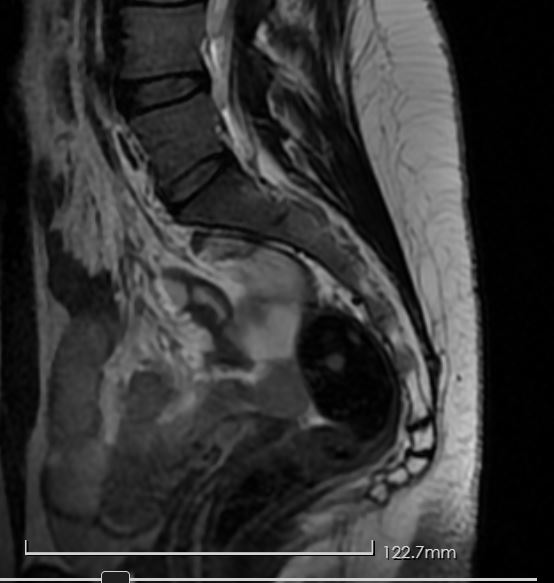 Lena MRI