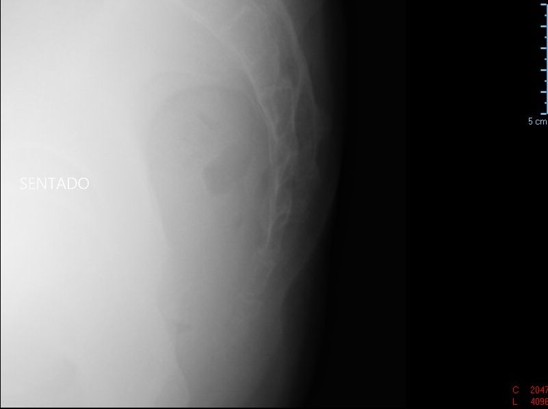 Sitting x-ray