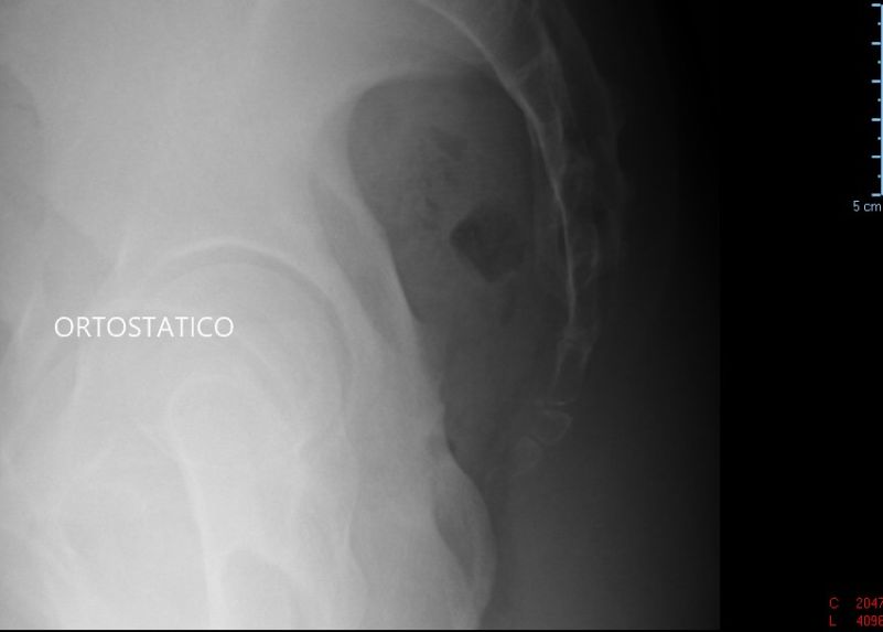 standing x-ray