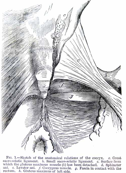 Fig 1. Sketch of the anatomical relations of the coccyx