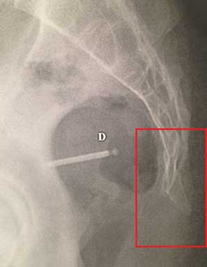 x-rays